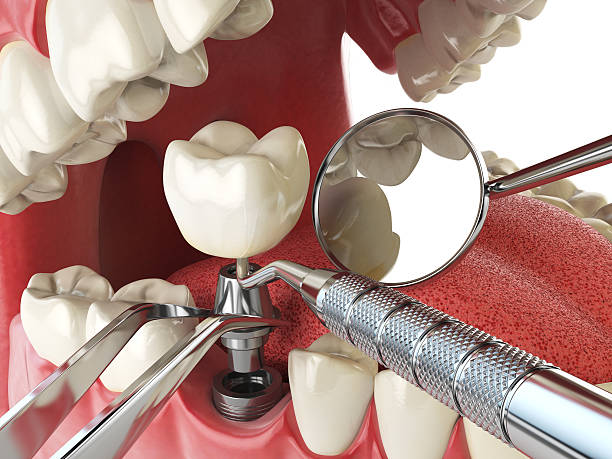 Best Pediatric Emergency Dentist in Mountain View, NC